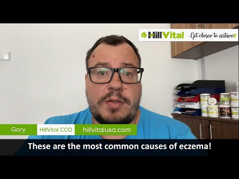 These are the most common causes of eczema!