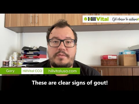 These are clear signs of gout!