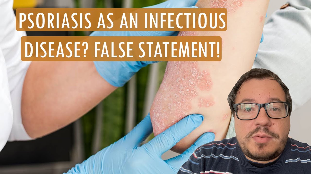 ☝️Psoriasis as an infectious disease? False statement! - hillvitalusa.com