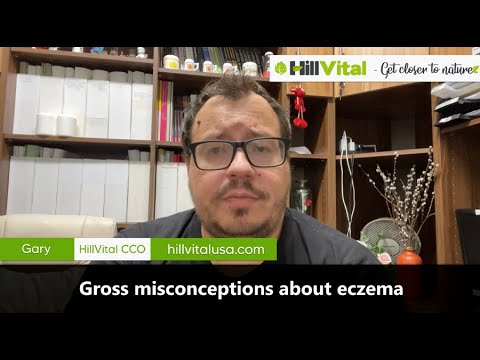 Gross misconceptions about eczema