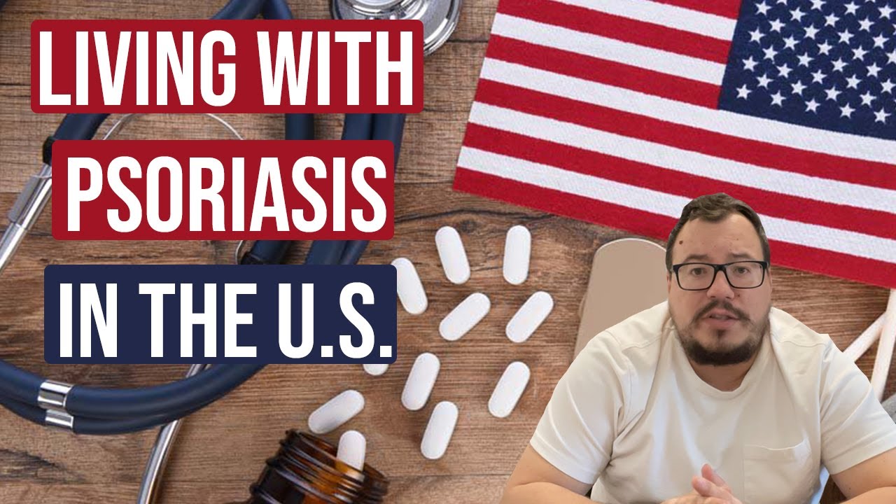 😮Living with Psoriasis in the U.S. - hillvital.hu