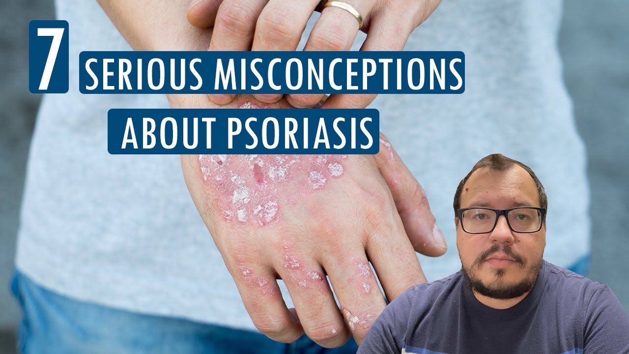 7 serious misconceptions about psoriasis😮 - hillvitalusa.com