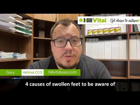 4 causes of swollen feet to be aware of!