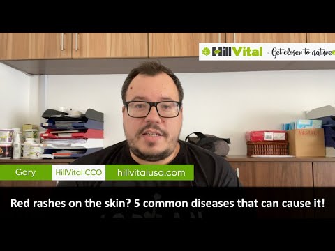 Red rashes on the skin5 common diseases that can cause it!