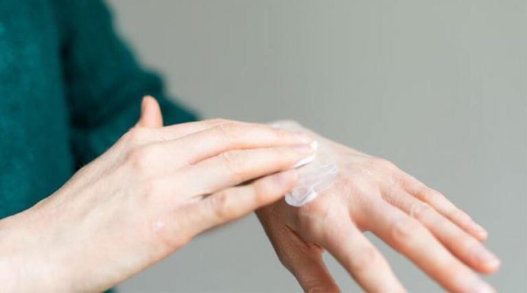 a women applying anti inflammatory cream on her hands