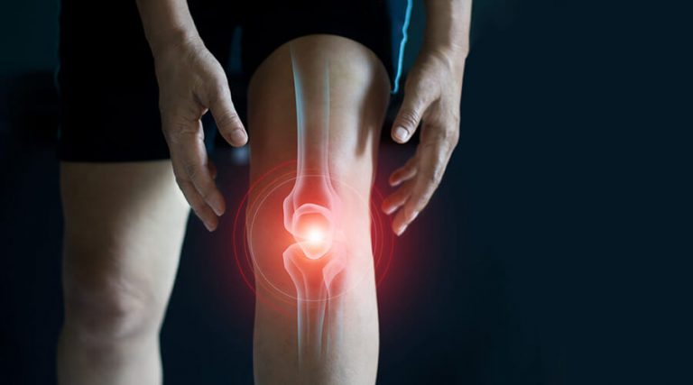 Serious Causes of joint pain.