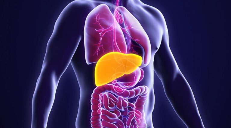 3D image of non alcoholic fatty liver