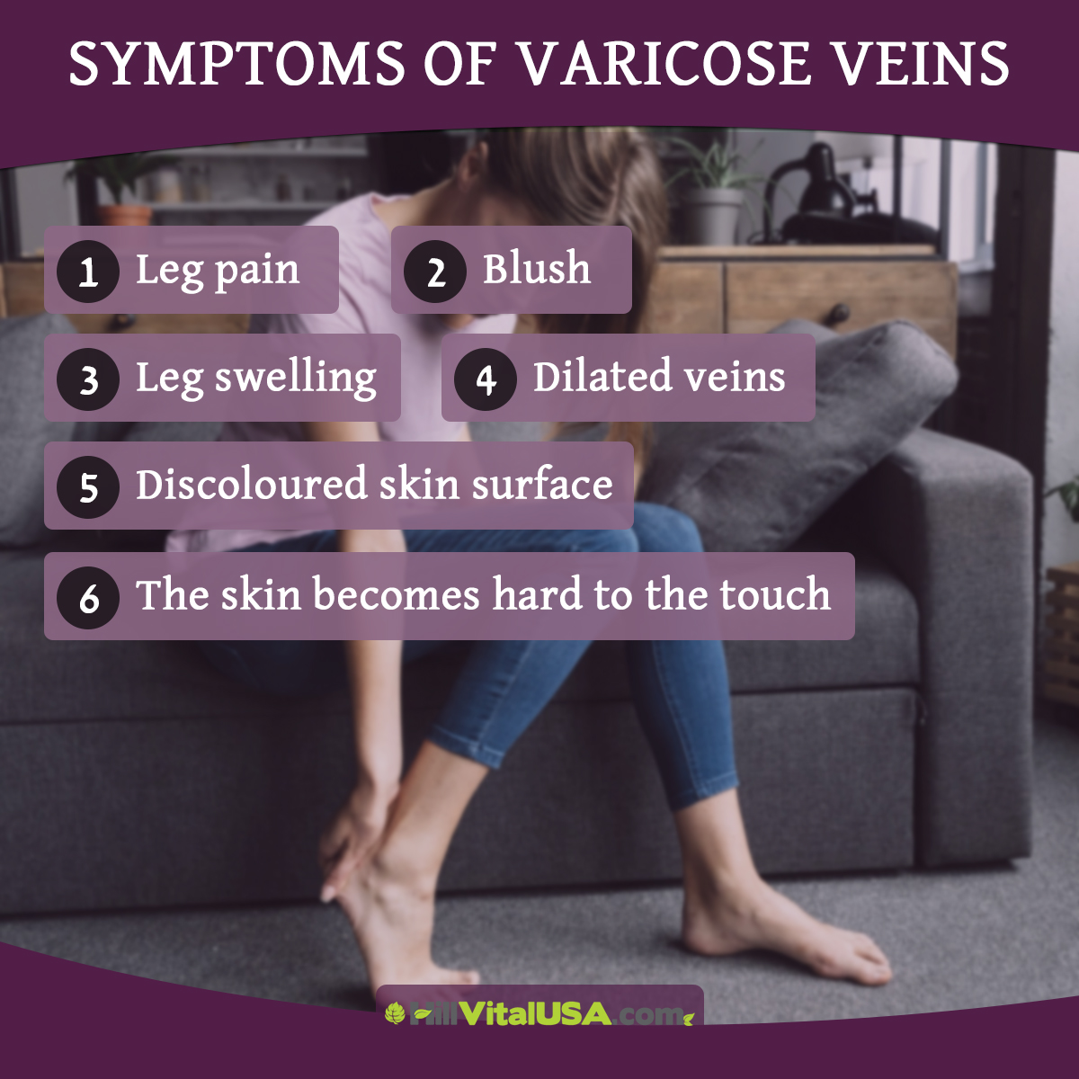 Symptoms of varicose veins