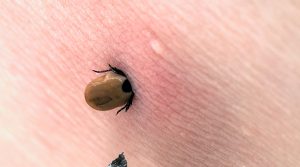 That's why you could have Lyme disease! How to recognise it