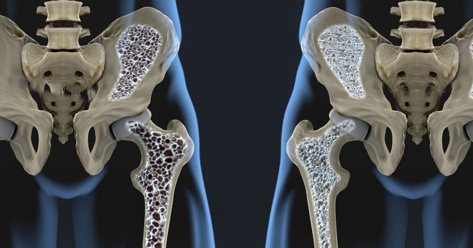 6 signs that may indicate a calcium deficiency.