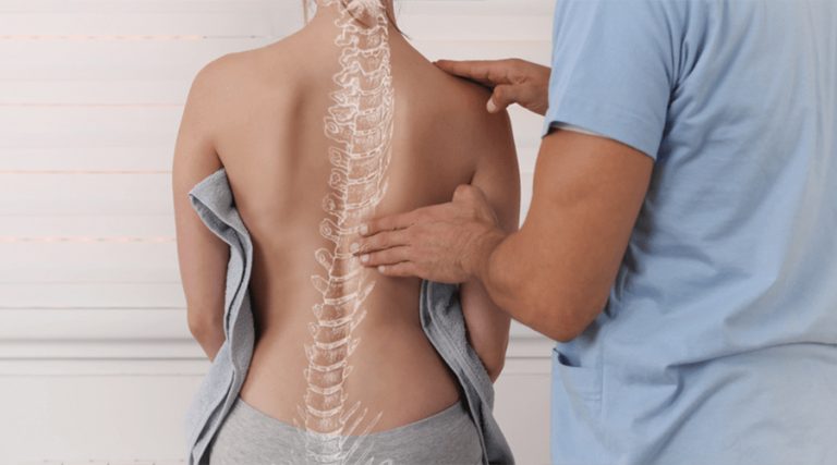 doctor checking signs that could indicate osteoporosis
