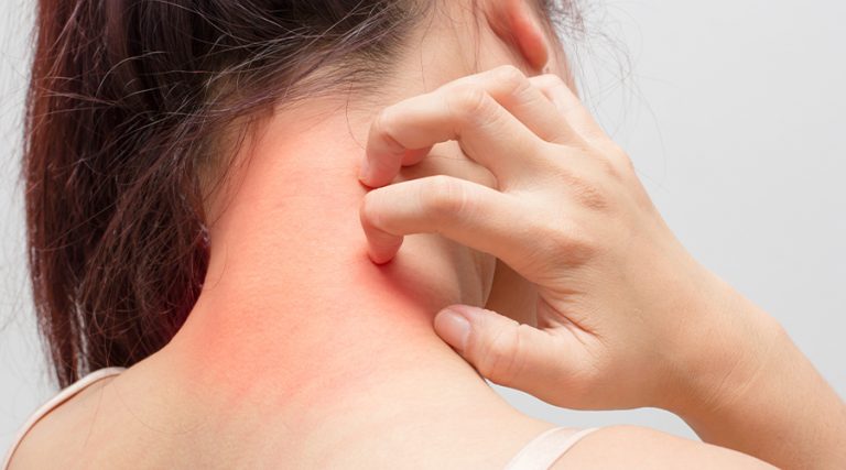 women scratching her neck