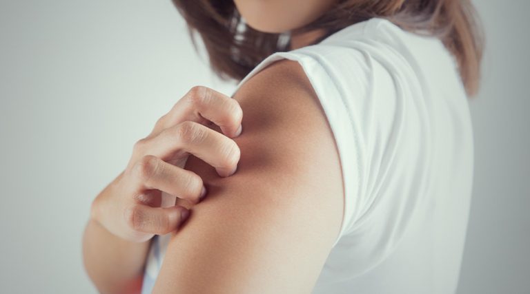 women scratching her arms