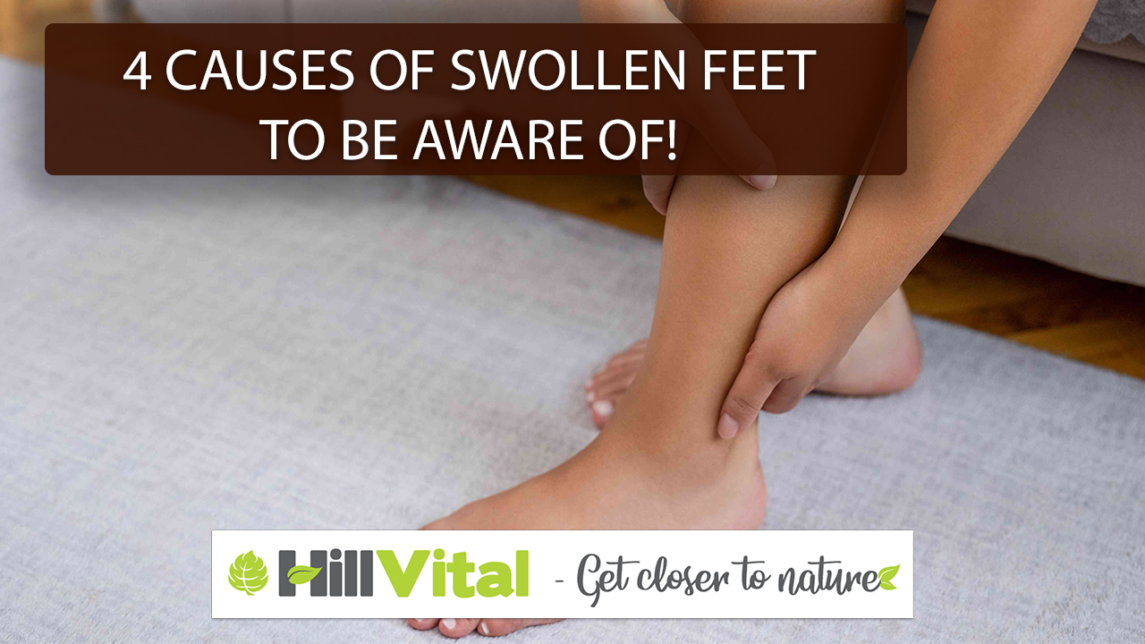 4 causes of swollen feet to be aware of!