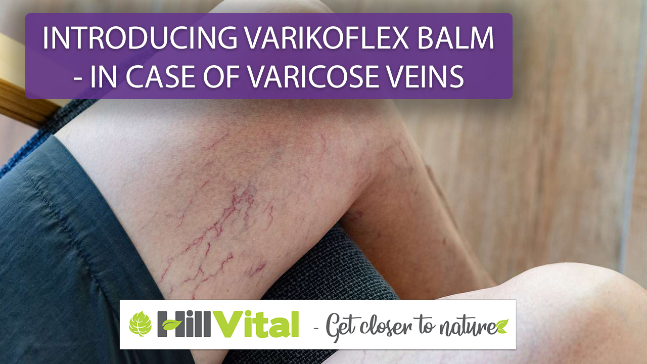 Introducing Varikoflex balm - in case of varicose veins