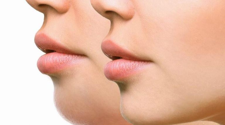 closeup of women lips and chin