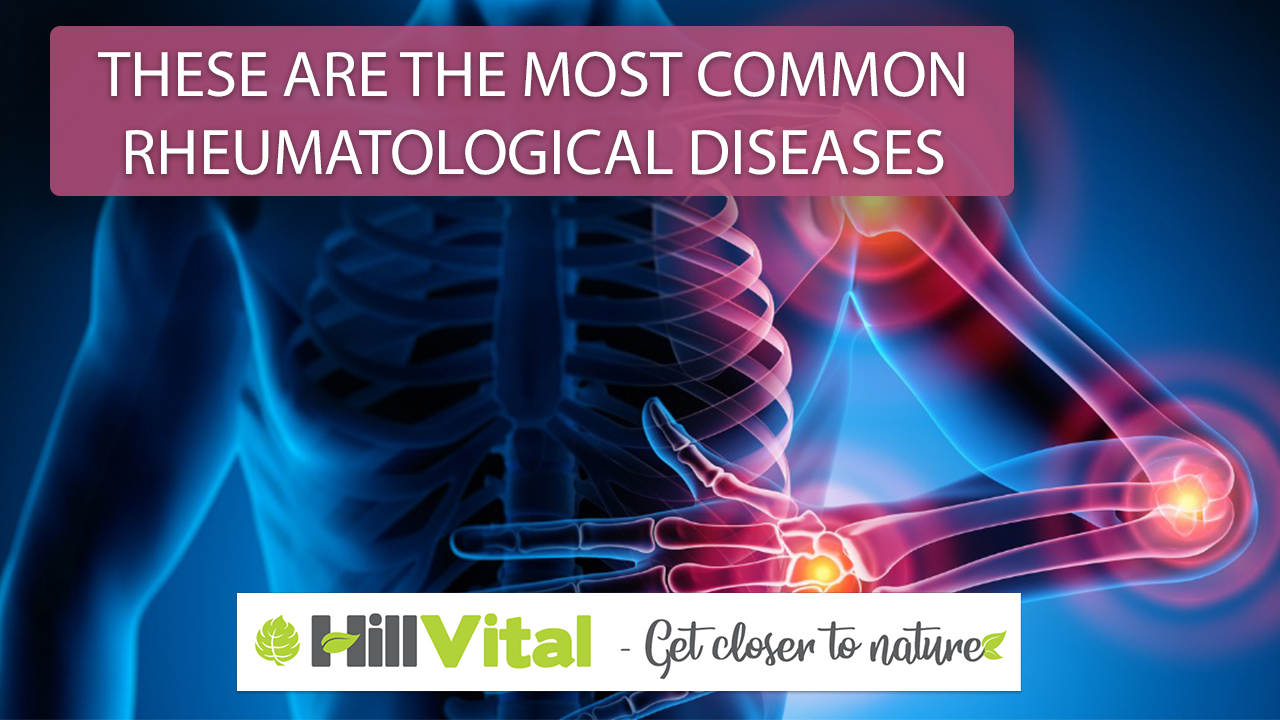 These are the most common rheumatological diseases