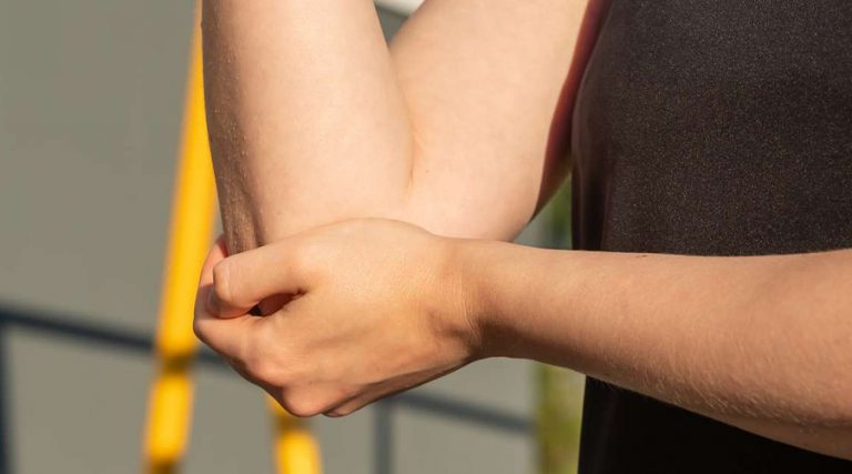 a person holding her elbow in pain