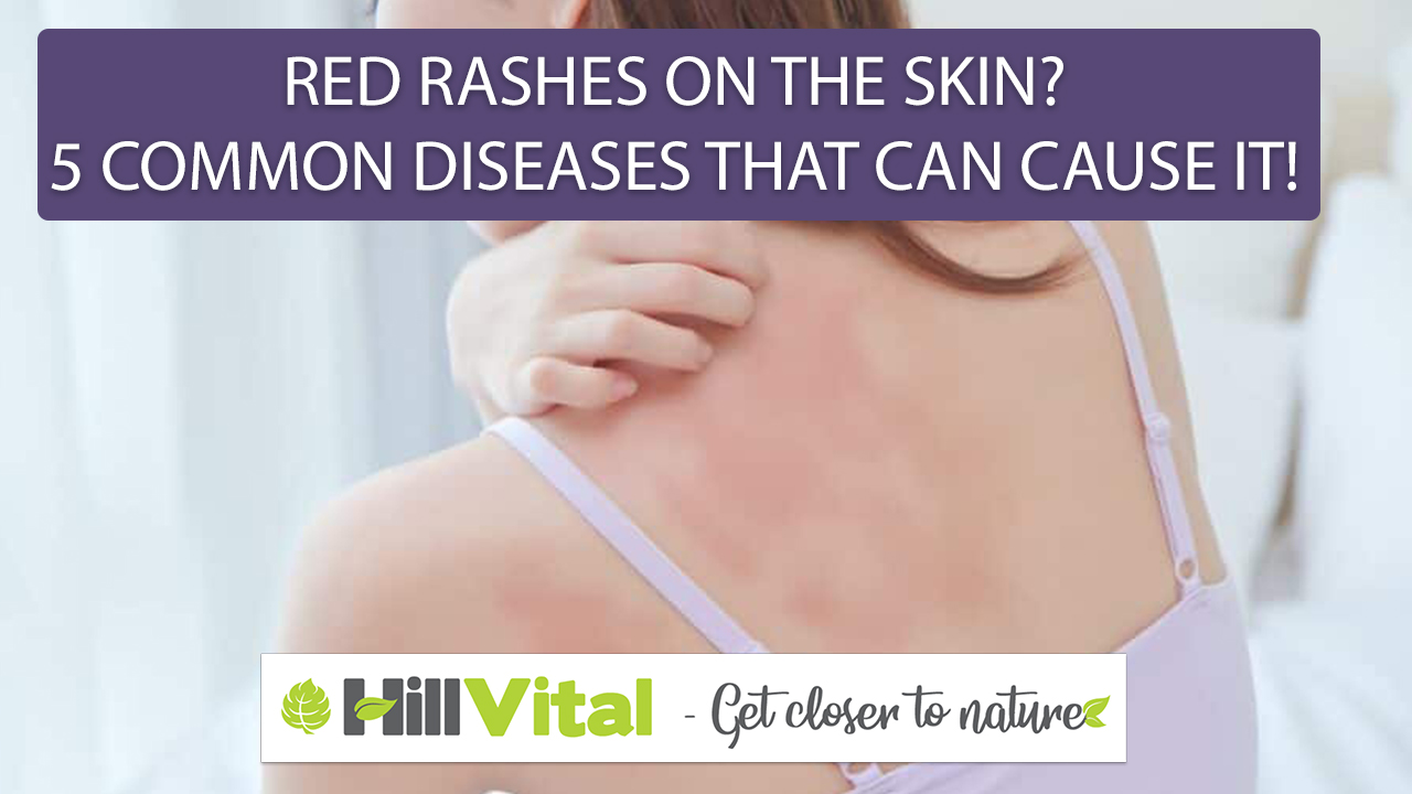 Red rashes on the skin