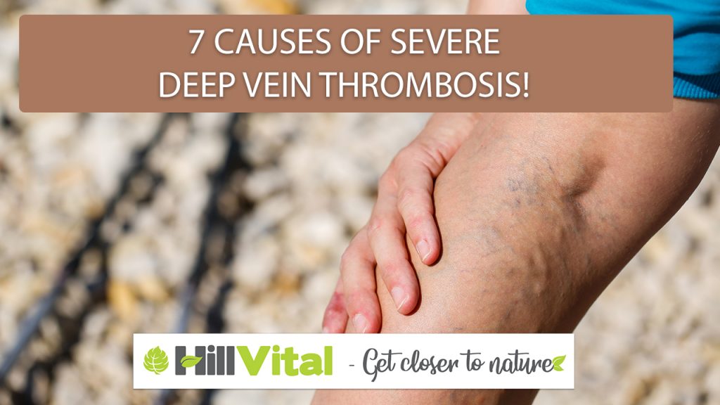 a person with deep vein thrombosis placing his hands on the veins