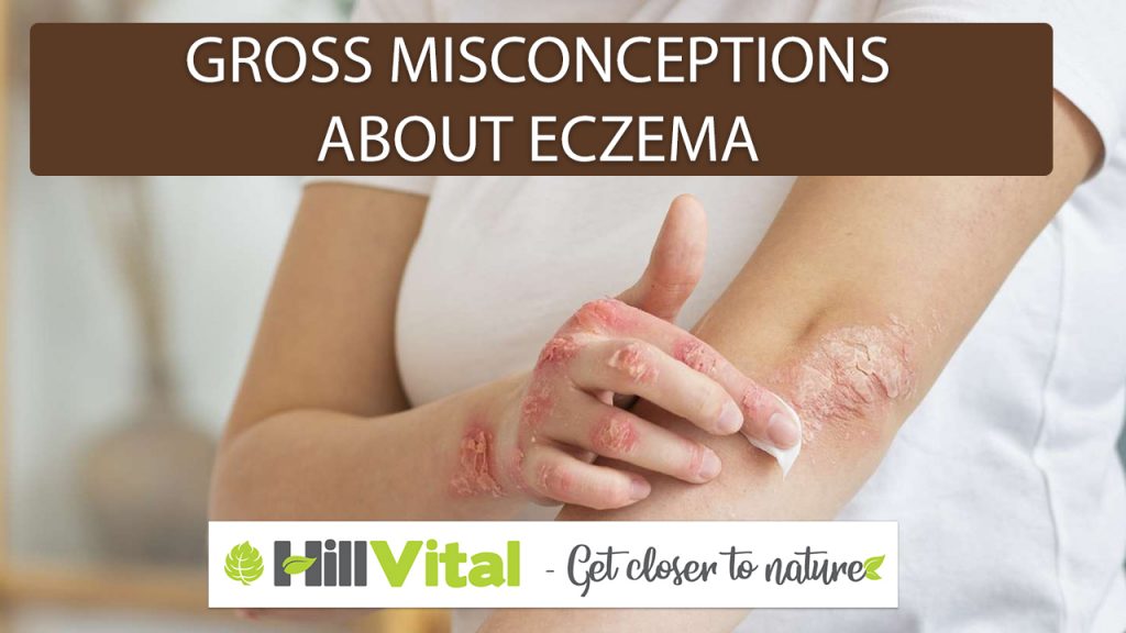 Gross misconceptions about eczema 8 a women applying balm on eczema on her arms
