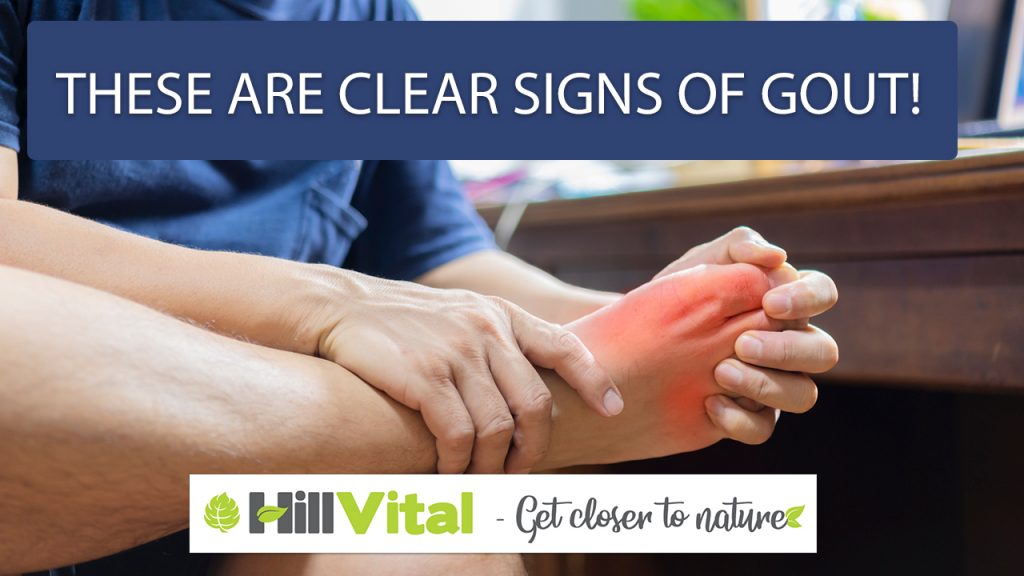 These are obvious signs of gout! 10 a man suffering from hives pressing his legs in pain