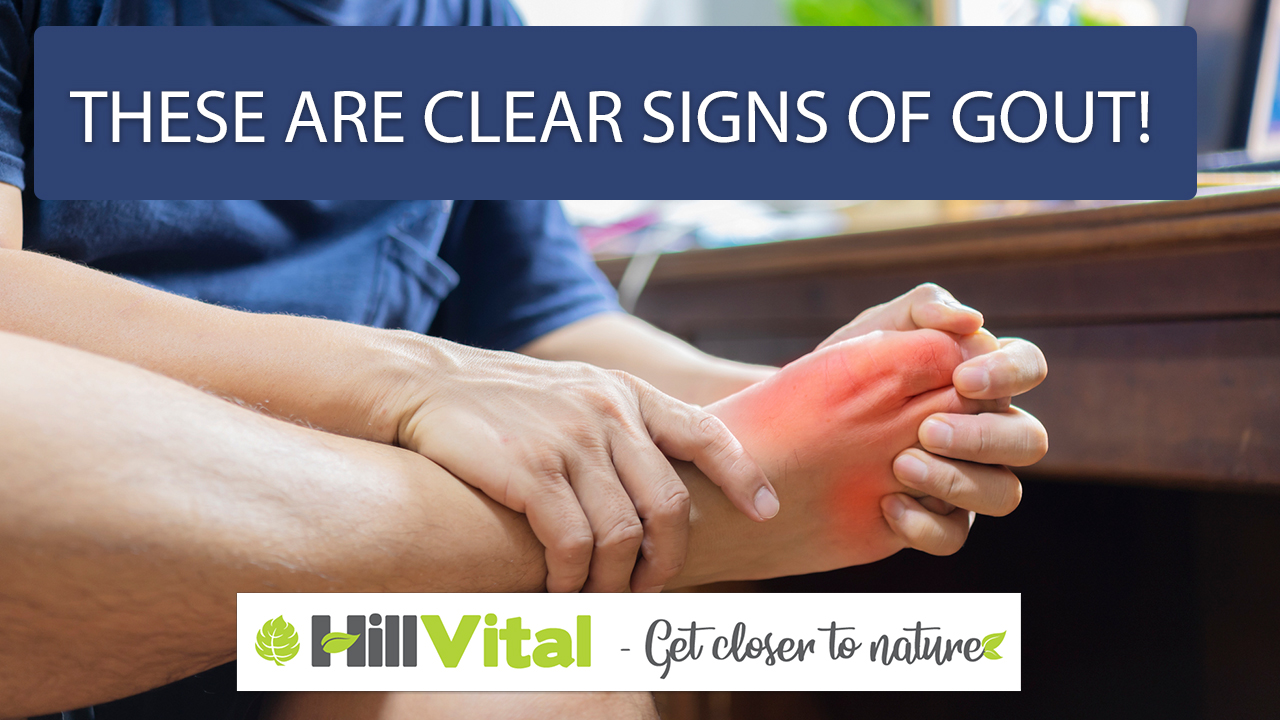 These are clear signs of gout!