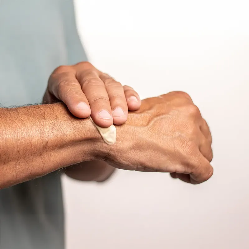 the man applies balm to his sore wrist