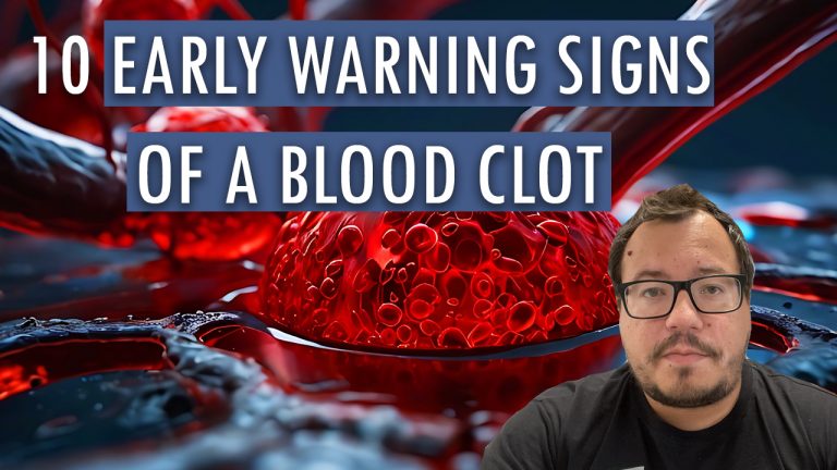 thumbnail of video showing 10 early warning signs of a blood clot