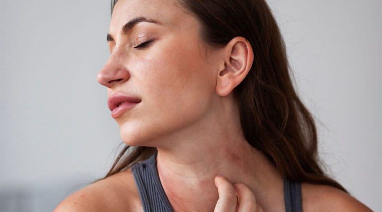 Treating seborrhoea and dermatitis at home