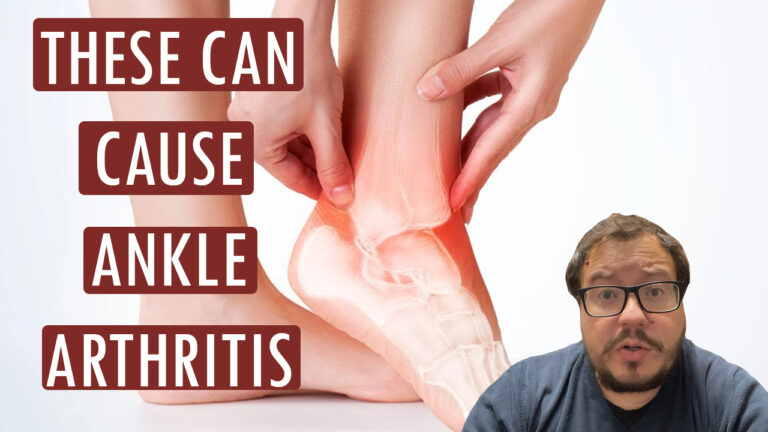 These can cause ankle arthritis