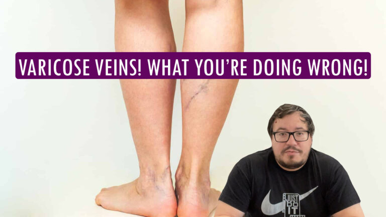 Varicose Veins – What You’re Doing Wrong!