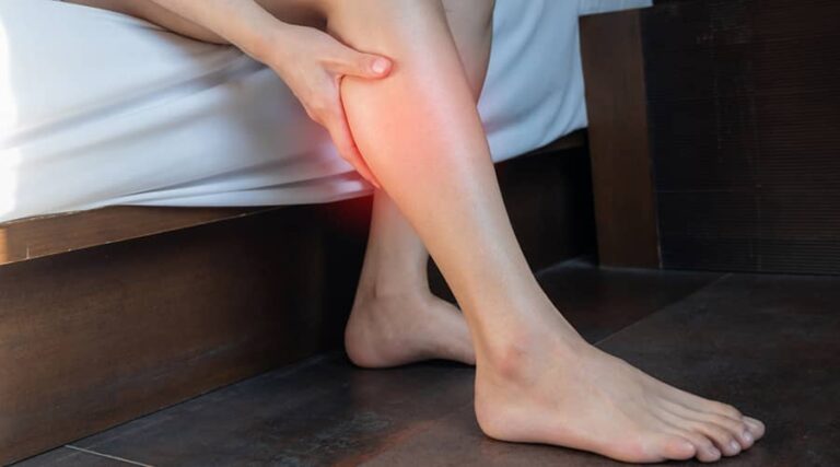 Tired legs in case of varicose veins