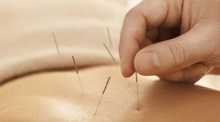 Acupuncture for Joint Pain
