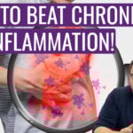 Chronic Inflammation – The Silent Trigger Behind Modern Diseases