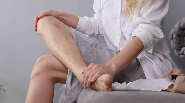 "Heavy Legs" and Leg Cramps